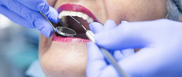 Best Emergency Broken Tooth Repair in Houston, TX